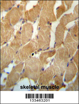 NDUFAF2 Antibody (Center)