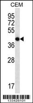 OR7G2 Antibody (C-term)