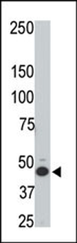 HtrA3 Antibody (N-term)