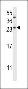 CHMP2B Antibody (N-term)