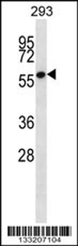 ZNF697 Antibody (N-term)