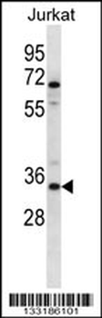 OR2G3 Antibody (C-term)