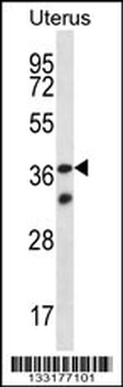 OR4X2 Antibody (C-term)