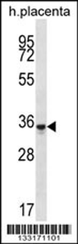 OR6K6 Antibody (C-term)