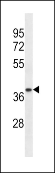 TRA2A Antibody (Center)