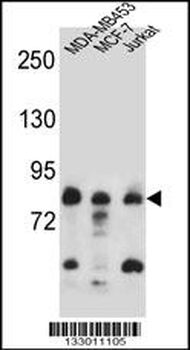 AFG3L2 Antibody (N-term)