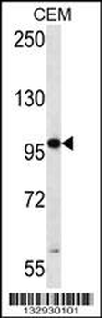 RNF43 Antibody (C-term)
