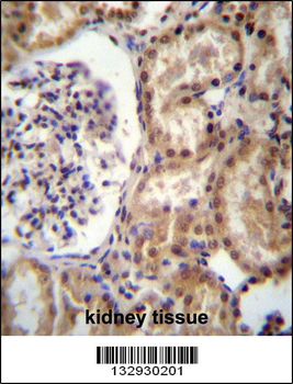 RNF43 Antibody (C-term)