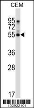 PALMD Antibody (N-term)