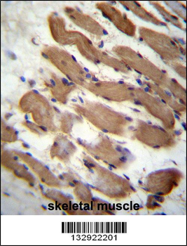 PALMD Antibody (N-term)