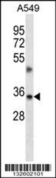 TMBIM1 Antibody (N-term)