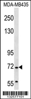 GRHL2 Antibody (Center)