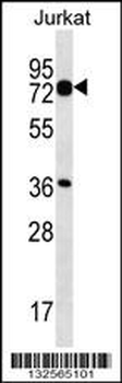 PLS1 Antibody (C-term)