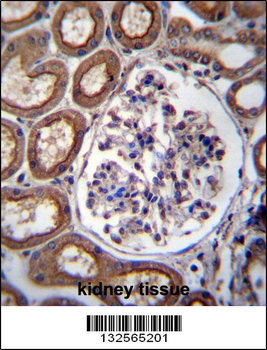 PLS1 Antibody (C-term)