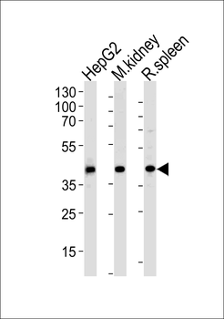 ACADL Antibody (N-term)