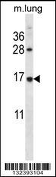 RPL27 Antibody (C-term)