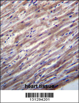 RASD1 Antibody (C-term)