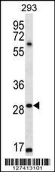 MESP1 Antibody (N-term)