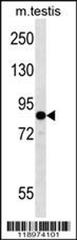 EIF2B5 Antibody (N-term)