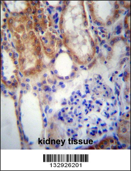 SUSD2 Antibody (C-term)
