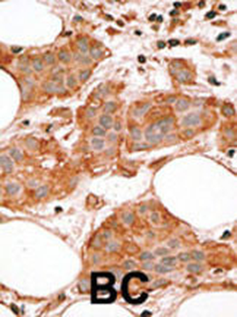 Bcl-G BH3 Domain Antibody