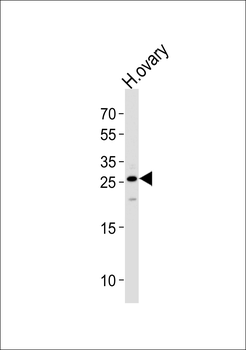 CCDC90B Antibody (Center)