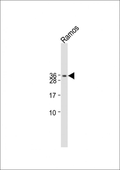 CGB/HCG-Beta Antibody (C-term)