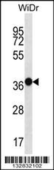 MUC15 Antibody (C-term)