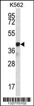 SP6 Antibody (Center)