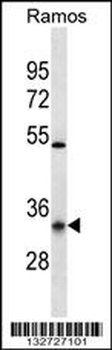 OR10G9 Antibody (C-term)