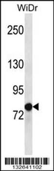 LZTS2 Antibody (C-term)