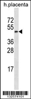 GAL3ST4 Antibody (Center)