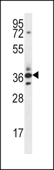 SFRP5 Antibody (Center)