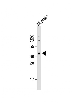 ELAVL2 Antibody (Center)