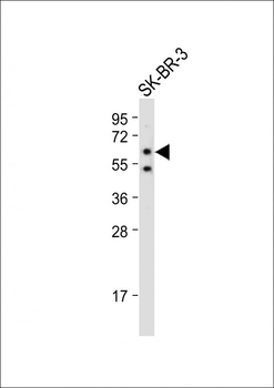 SLC15A3 Antibody (Center)