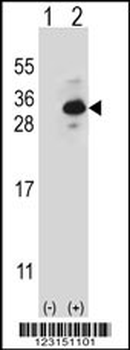 CLTB Antibody