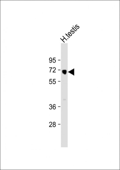 HIPK4 Antibody