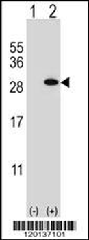 GSTT1 Antibody (N-term)