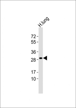 GSTT1 Antibody (N-term)