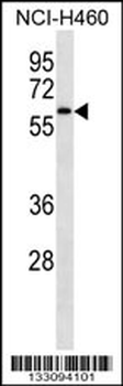 IRAK4 Antibody (N-term)