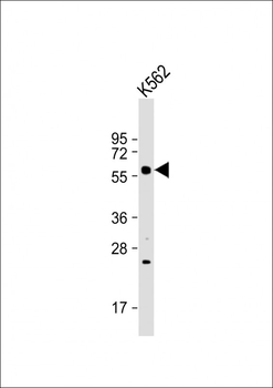 IRAK4 Antibody (N-term)