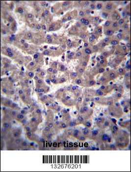 PTGR2 Antibody (N-term)