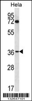 NUP35 Antibody (C-term)