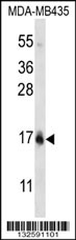HIST1H2BC/HIST1H2BF Antibody (N-term)
