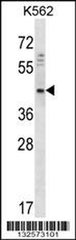 DOC2A Antibody (Center)