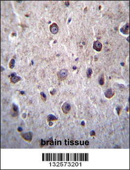 DOC2A Antibody (Center)