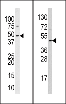 SUV39H2 Antibody (C-term)