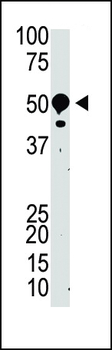 SUV39H2 Antibody (N-term)