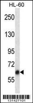 CB044 Antibody (N-term)