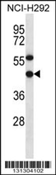 EBNA1BP2 Antibody (C-term)